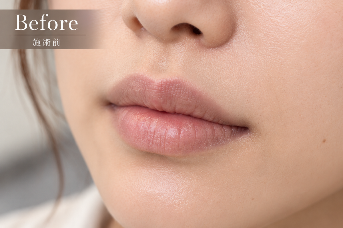 Full Lip Color 施術前